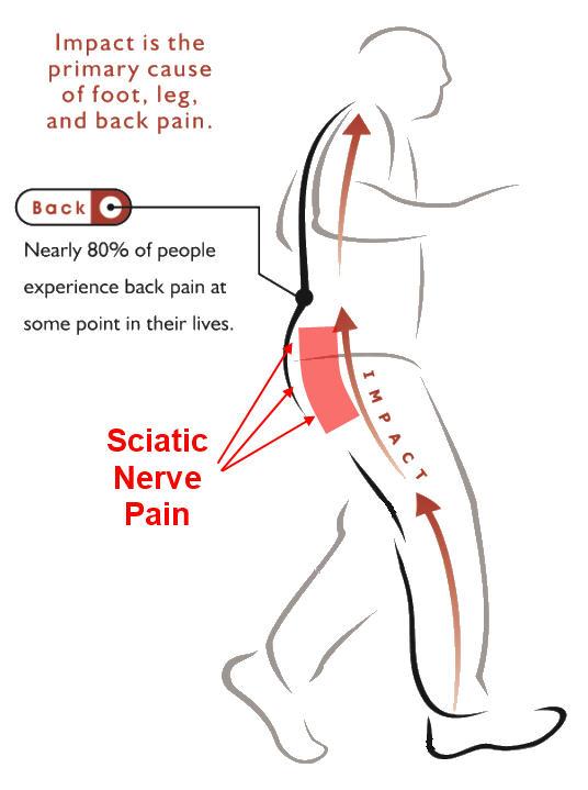 back pain sciatica relief