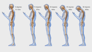 tip: solve neck pain spine cutting smartphone usage