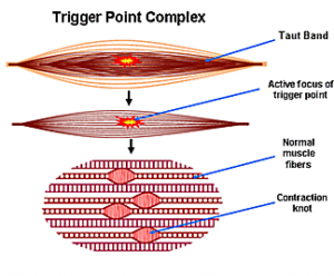 trigger point muscle massage