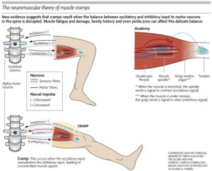 muscle cramps causes remedies